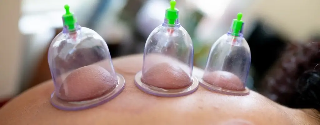 Cupping Compressed