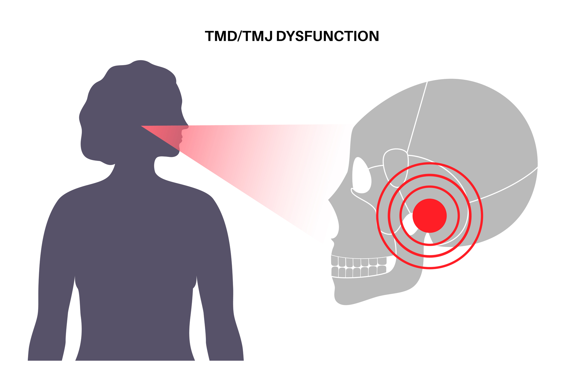 How Chiropractic Therapy Eases TMJ Dysfunction